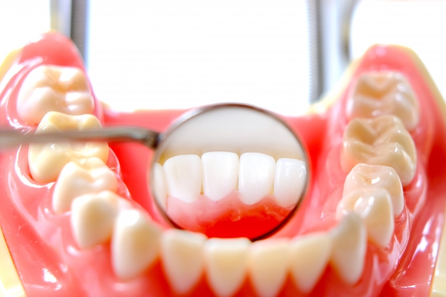 歯周病検診画像